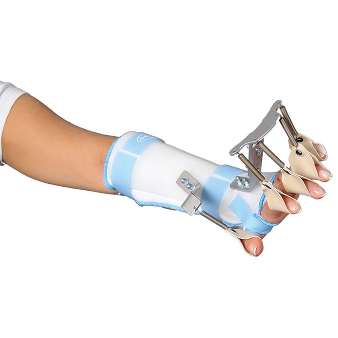 Yuxarı ətraf ortezləri