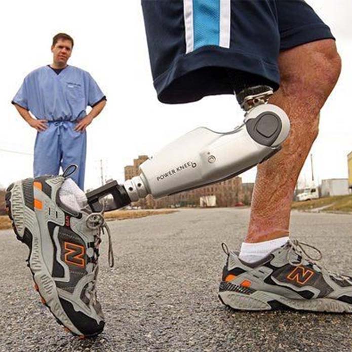 Aşağı ətraf protezləri